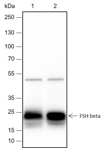 Recombinant FSH beta Monoclonal Antibody (AN301699L)