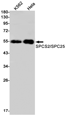 Recombinant WTAP Monoclonal Antibody (E-AB-81431)