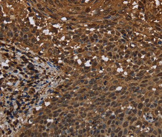 MYBBP1A Polyclonal Antibody (E-AB-16625)