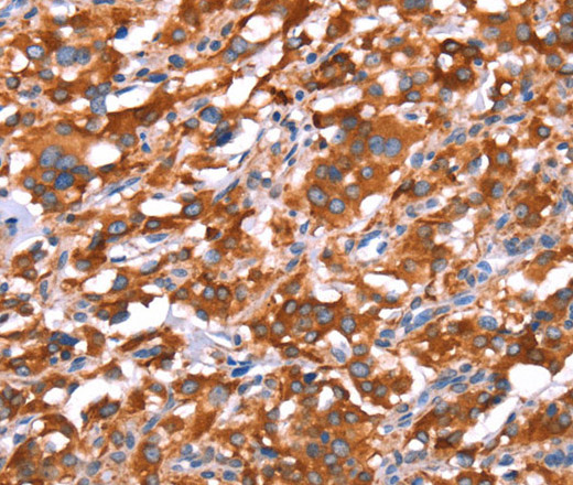 GAS8 Polyclonal Antibody (E-AB-13260)