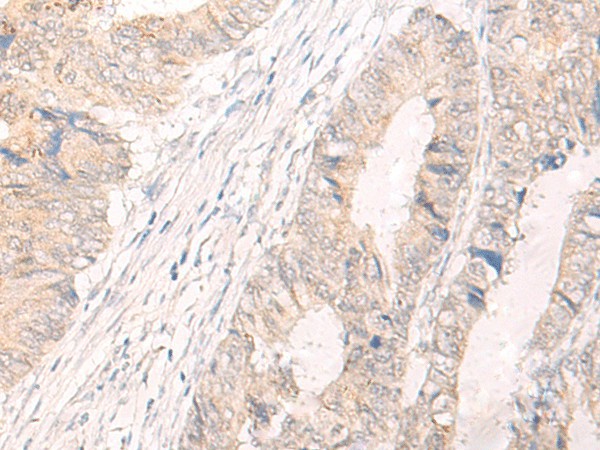 IL33 Polyclonal Antibody (E-AB-17914)