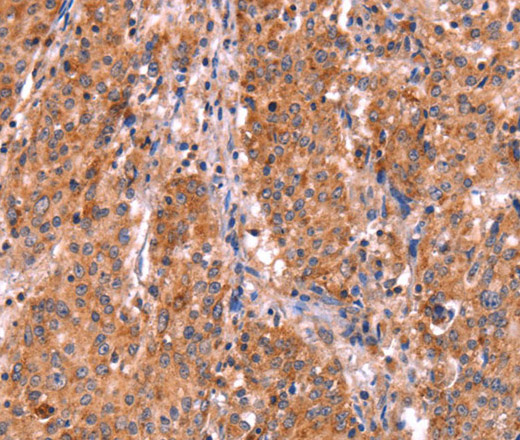 ABI1 Polyclonal Antibody (E-AB-12222)