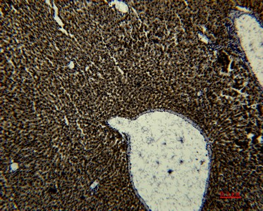 Transferrin Monoclonal Antibody (E-AB-22182)