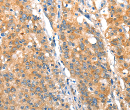 ST14 Polyclonal Antibody (E-AB-10449)