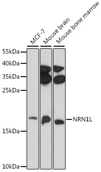 NRN1L Polyclonal Antibody (E-AB-91590)
