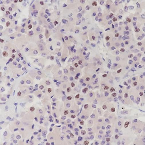 Recombinant PITX2/RGS Monoclonal Antibody (AN301631L)