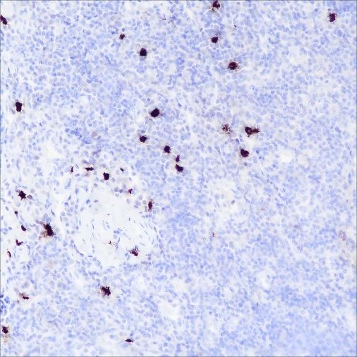 Recombinant TPSAB1 Monoclonal Antibody (AN301678L)