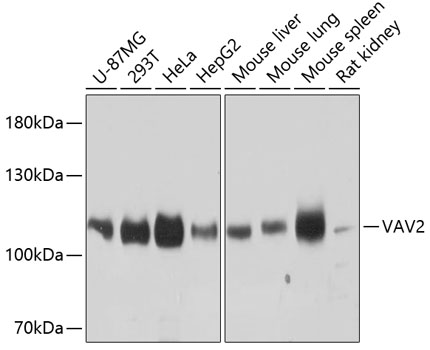 VAV2 Polyclonal Antibody (E-AB-65628)