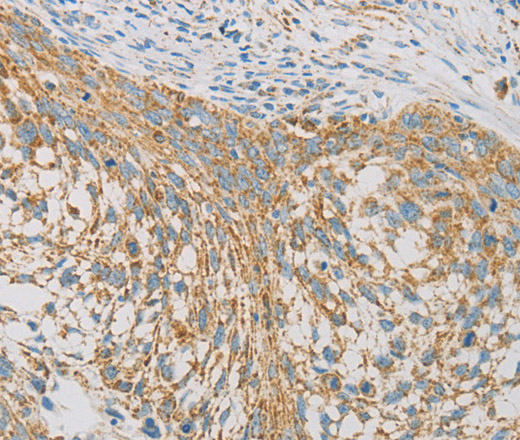 REN Polyclonal Antibody (E-AB-14668)