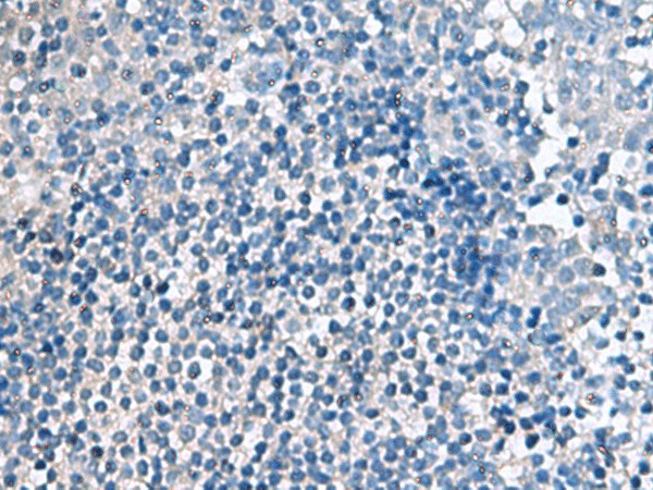 EIF4A2 Polyclonal Antibody (E-AB-53065)