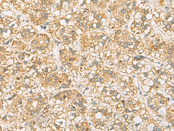 FAAP100 Polyclonal Antibody (E-AB-53103)