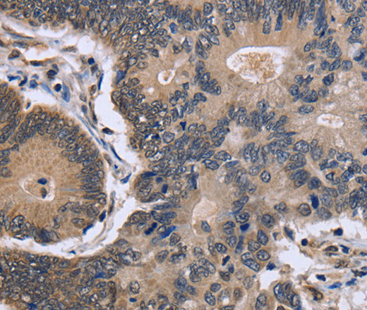 FSTL1 Polyclonal Antibody (E-AB-15048)