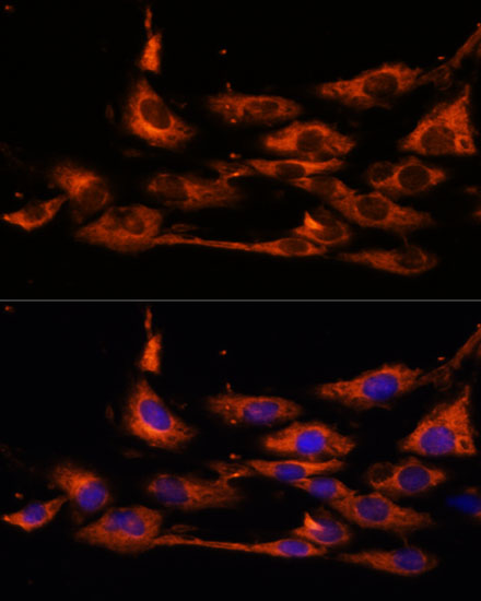 ACOX3 Polyclonal Antibody (E-AB-91682)