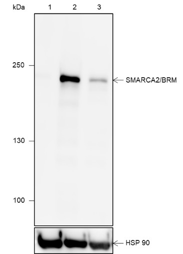 Recombinant SMARCA2/BRM Monoclonal Antibody (AN301908L)