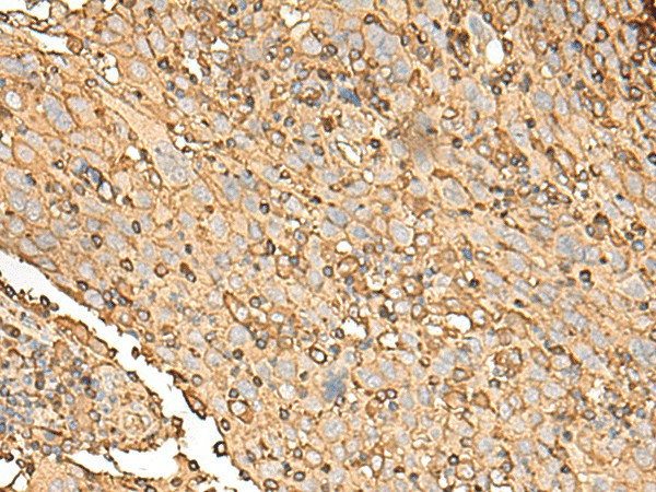 UBE2A Polyclonal Antibody (E-AB-18779)
