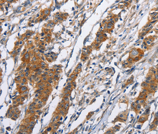 NCAPD3 Polyclonal Antibody (E-AB-11028)