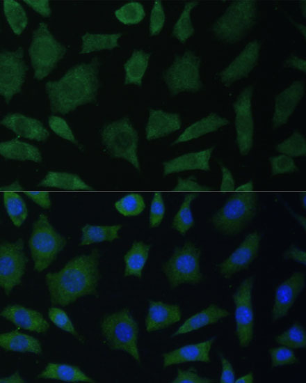 PTK2B Polyclonal Antibody (E-AB-66666)