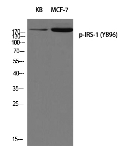 Phospho-IRS1 (Tyr896) Polyclonal Antibody (E-AB-21407)