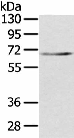 TBL1X Polyclonal Antibody (E-AB-17053)