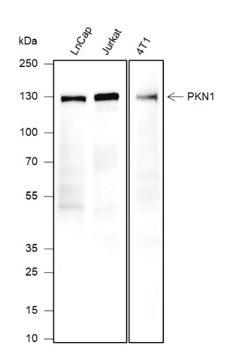 Recombinant PKN1 Monoclonal Antibody (AN301632L)