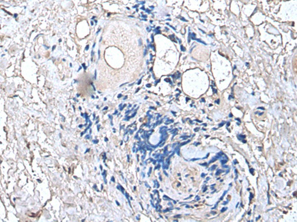 PTP4A1 Polyclonal Antibody (E-AB-18276)