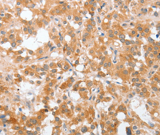 cPLA2 Polyclonal Antibody (E-AB-14890)