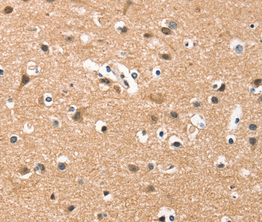 HDAC8 Polyclonal Antibody (E-AB-10365)