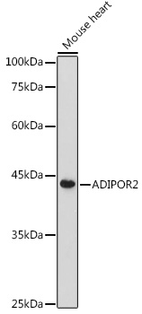 ADIPOR2 Polyclonal Antibody (E-AB-90480)