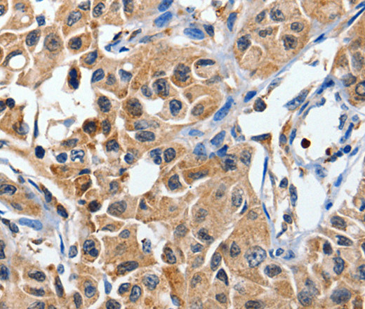 DUSP8 Polyclonal Antibody (E-AB-12399)