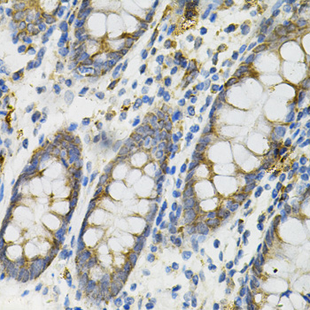 DEFB132 Polyclonal Antibody (E-AB-64791)