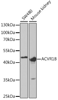 ACVR1B Polyclonal Antibody (E-AB-60969)