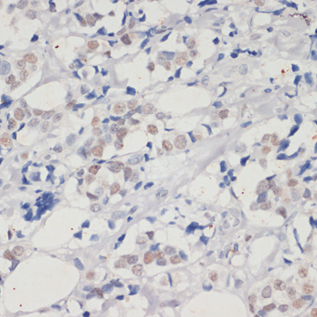 (KO Validated) DNMT1 Polyclonal Antibody (E-AB-66916)