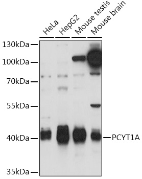 PCYT1A Polyclonal Antibody (E-AB-91661)