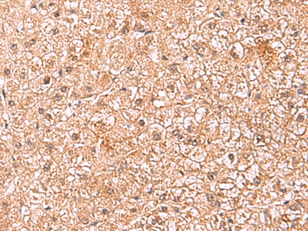 ASTN2 Polyclonal Antibody (E-AB-19040)