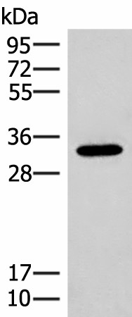RGR Polyclonal Antibody (E-AB-19982)
