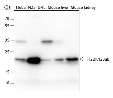 Recombinant Histone H2B (Ubiquityl Lys120) Monoclonal Antibody (AN302107L)