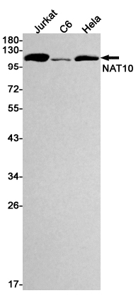 Recombinant NAT10 Monoclonal Antibody (E-AB-81427)