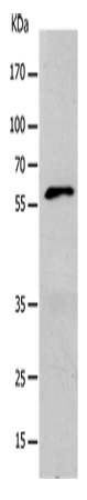 KCNC1 Polyclonal Antibody (E-AB-15743)