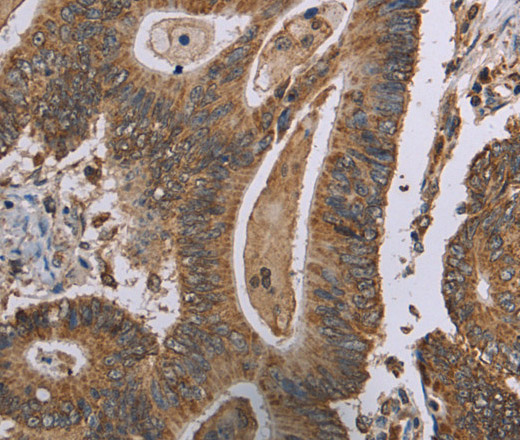 MRGPRX1 Polyclonal Antibody (E-AB-16618)