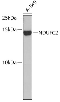 NDUFC2 Polyclonal Antibody (E-AB-92523)