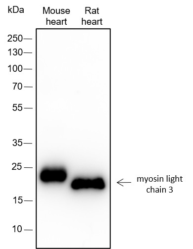Recombinant Myosin Light Chain 3 Monoclonal Antibody (AN301607L)