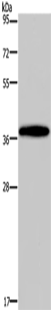 DLX4 Polyclonal Antibody (E-AB-14956)