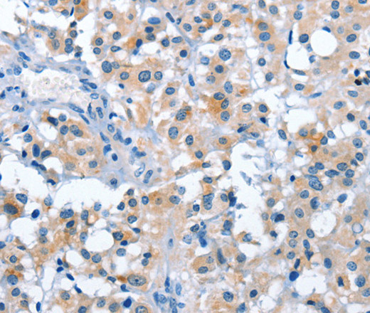 ASB2 Polyclonal Antibody (E-AB-10983)