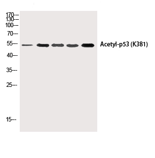 Acetyl-P53 (Lys381) Polyclonal Antibody (E-AB-20287)