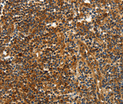 CNNM3 Polyclonal Antibody (E-AB-14028)