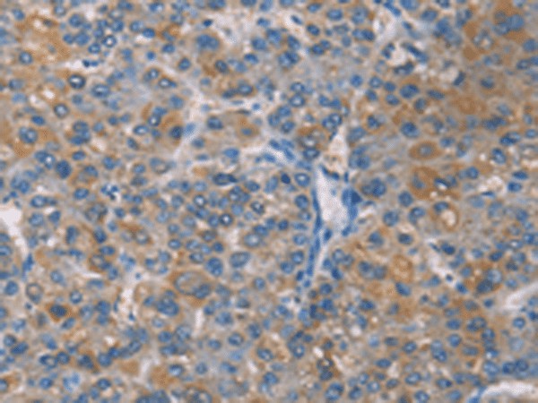 ZBTB1 Polyclonal Antibody (E-AB-53221)