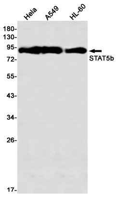 Recombinant STAT5b Monoclonal Antibody (E-AB-81513)