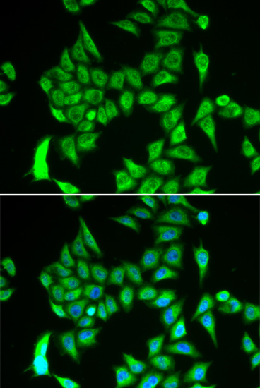 IREB2 Polyclonal Antibody (E-AB-62801)