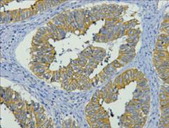 CK-19 Monoclonal Antibody (E-AB-22014)
