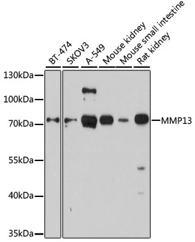 (KO Validated) MMP13 Polyclonal Antibody (E-AB-64101)